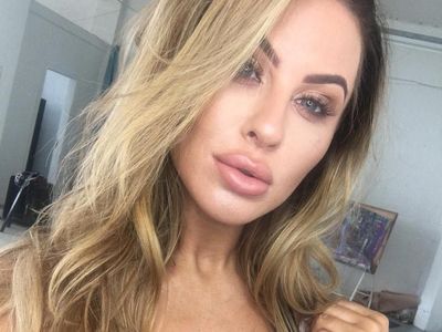 Potret Selebgram yang Bibirnya Kempes Setelah Hapus Filler ala Kylie Jenner