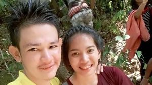 Potret Wanita Setia Dampingi Kekasih yang Wajahnya Rusak Ini Bikin Terenyuh