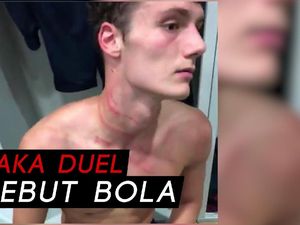 Ngeri! Ini Kondisi Leher Pavard Usai Diinjak Antonio Rudiger