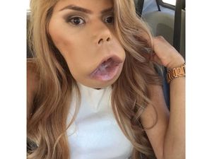 Kisah Wanita dengan Tumor Mulut yang Sukses Jadi Beauty Vlogger