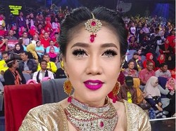 Erie Suzan Perlihatkan Kaki Membesar, Kenapa Ya?