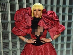 Nicki Minaj Sebut Orang yang Pernah Operasi Plastik Pasti Menyesal