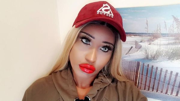 Foto: Wanita Ini Habiskan Rp 195 Juta Demi Mirip Boneka Seks