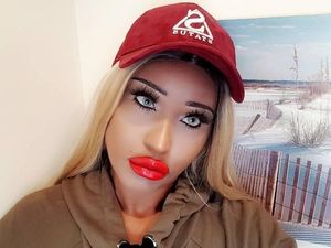 Foto: Wanita Ini Habiskan Rp 195 Juta Demi Mirip Boneka Seks