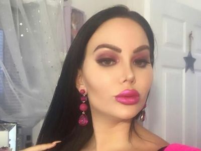 Seperti Ini Wajah Wanita yang 200 Kali Operasi Plastik, Takut Bokong Meledak