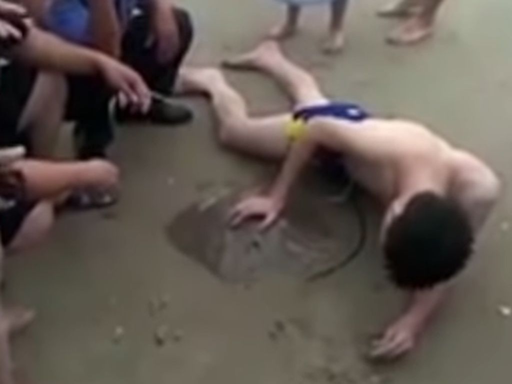 Ouch! Penis Pria Ini Tersengat Ikan Pari Saat Berenang di Laut Ouch! Penis Pria Ini Tersengat Ikan Pari Saat Berenang di Laut