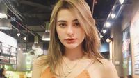 Pesona Nora Alexandra, Model Cantik yang Punya Bibir Seksi