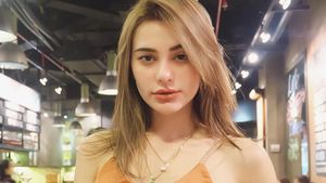 Pesona Nora Alexandra, Model Cantik yang Punya Bibir Seksi