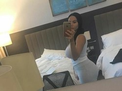 Implan Bokong Mengendur, Penampilan Wanita Ini Seperti Pakai Popok