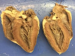 Punya Ritual Aneh, Kampus Ini Paksa Siswanya Makan Hati Domba Mentah