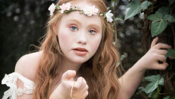 Liburannya Model Down Syndrom Cantik, Madeline Stuart