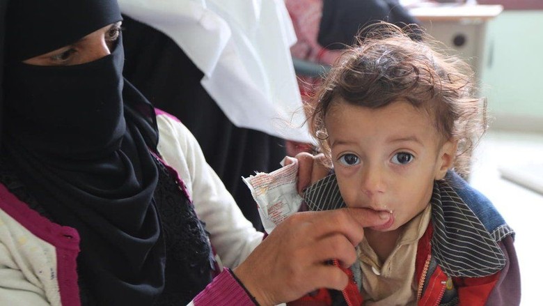 Kelaparan Ancam 5 Juta Bocah Yaman, Bayi Terlalu Lemah Untuk Menangis Kelaparan Ancam 5 Juta Bocah Yaman, Bayi Terlalu Lemah Untuk Menangis