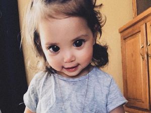 Kondisi Langka Membuat Anak Ini Bermata Besar dan Indah