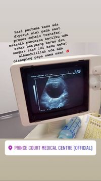 Bella Shofie Jalani Bayi Tabung, Begini Prosedurnya