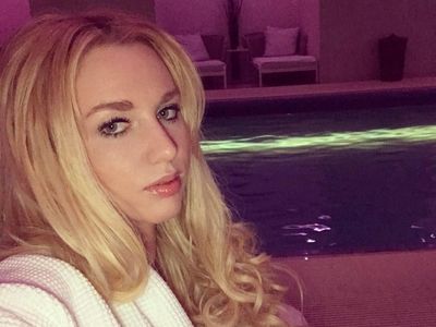 Potret Anna Shapiro, Model Seksi Rusia yang Mengaku Diracun Vladimir Putin