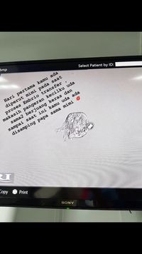 Bella Shofie Jalani Bayi Tabung, Begini Prosedurnya