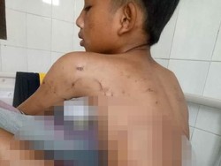 Cerita Bocah MI di Malang Selamat dari Keroyokan 6 Anjing Pemburu