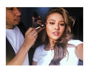 Seperti Roy Kiyoshi, Deretan Artis Ini Juga Veneer Gigi Kelinci