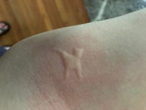 Potret Bentol-bentol Unik Dari Nyamuk yang Artistik