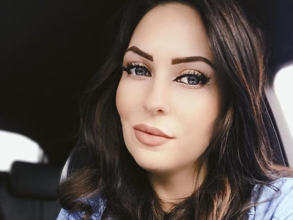 Foto Before-After Wanita yang Habiskan Rp 78 Juta Demi Punya Wajah Baru