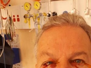 Seorang Warga Canberra Diserang Kanguru yang Dikira Sudah Mati