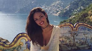 Foto: Model Victoria Secret yang Luka-luka Digigit Kutu di Hotel