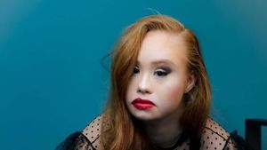 Ini Model Down Syndrome Pertama yang Bermimpi Tampil untuk Victorias Secret