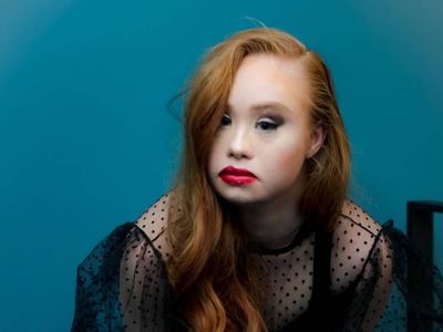 Ini Model Down Syndrome Pertama yang Bermimpi Tampil untuk Victorias Secret