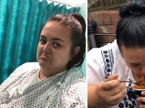 Ikut Tantangan Mie Pedas, Wanita Ini Masuk Rumah Sakit dan BAB Darah