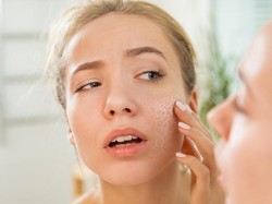 Efek Purging Setelah Coba Skin Care Baru, Amankah?