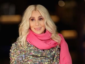 Foto: Wajah Cher yang Awet Muda di Usia 72 Berkat Operasi Plastik