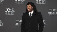 Rene Higuita dengan tampilan barunya. Saya capek menjadi Rene yang jelek. Saya mau menjadi Rene yang tampan, ucapnya saat ditanya soal operasi plastik yang dia lakukan. (AFP PHOTO / Adrian DENNIS)