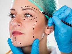 Seperti Ratna Sarumpaet, Ini Operasi Plastik Favorit Orang Indonesia