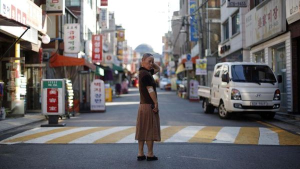 Wajahnya Jadi Rusak, Kisah Wanita Ngutang Rp 400 Juta Demi Operasi Plastik