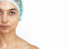 Mirisnya Nasib Wanita Korban Malapraktik Oplas, Bola Mata Terjahit ke Kulit