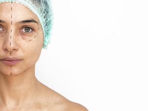 Mirisnya Nasib Wanita Korban Malapraktik Oplas, Bola Mata Terjahit ke Kulit Mirisnya Nasib Wanita Korban Malapraktik Oplas, Bola Mata Terjahit ke Kulit