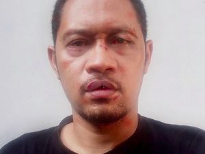 Operasi Plastik, Seniman Agan Harahap Manipulasi Foto Jadi Bonyok Operasi Plastik, Seniman Agan Harahap Manipulasi Foto Jadi Bonyok