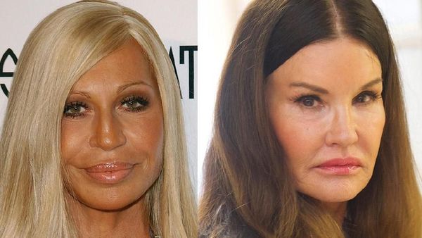 Ratna Sarumpaet Diisukan Operasi Plastik, Ini Artis yang Pernah Gagal