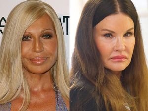 Ratna Sarumpaet Diisukan Operasi Plastik, Ini Artis yang Pernah Gagal