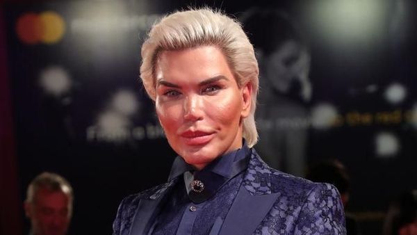 Operasi Plastik Bikin Sosok-sosok Ini Viral dan Kini Tenar