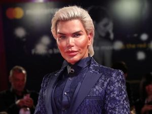 Mengaku Transgender, Pria yang Disebut Human Ken Doll Kini Jadi Human Barbie