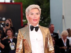 Ngeri! Hidung Pria Ini Jadi Menyusut Setelah 72 Kali Operasi Plastik