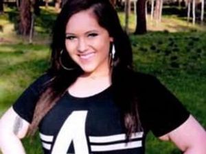 Jalani Operasi Demi Tubuh Langsing, Kulit Wanita Ini Jadi Seram