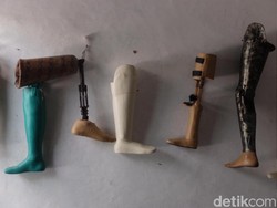Agar Tidak Infeksi, Begini Caranya Menjaga Kaki Prostetik dengan Benar
