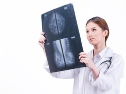 Viral Gambar Kelenjar Susu yang Menakutkan Ternyata Tidak Akurat