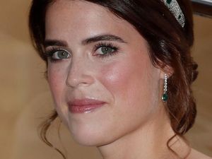 Putri Eugenie Pamer Bekas Luka Operasi Skoliosis, Ini Pesan Inspiratifnya