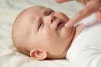 4 Tips Cegah Anak Alami Masalah Kulit