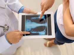 Hari Radiografi Sedunia 8 November, Peringati Penemuan Sinar-X