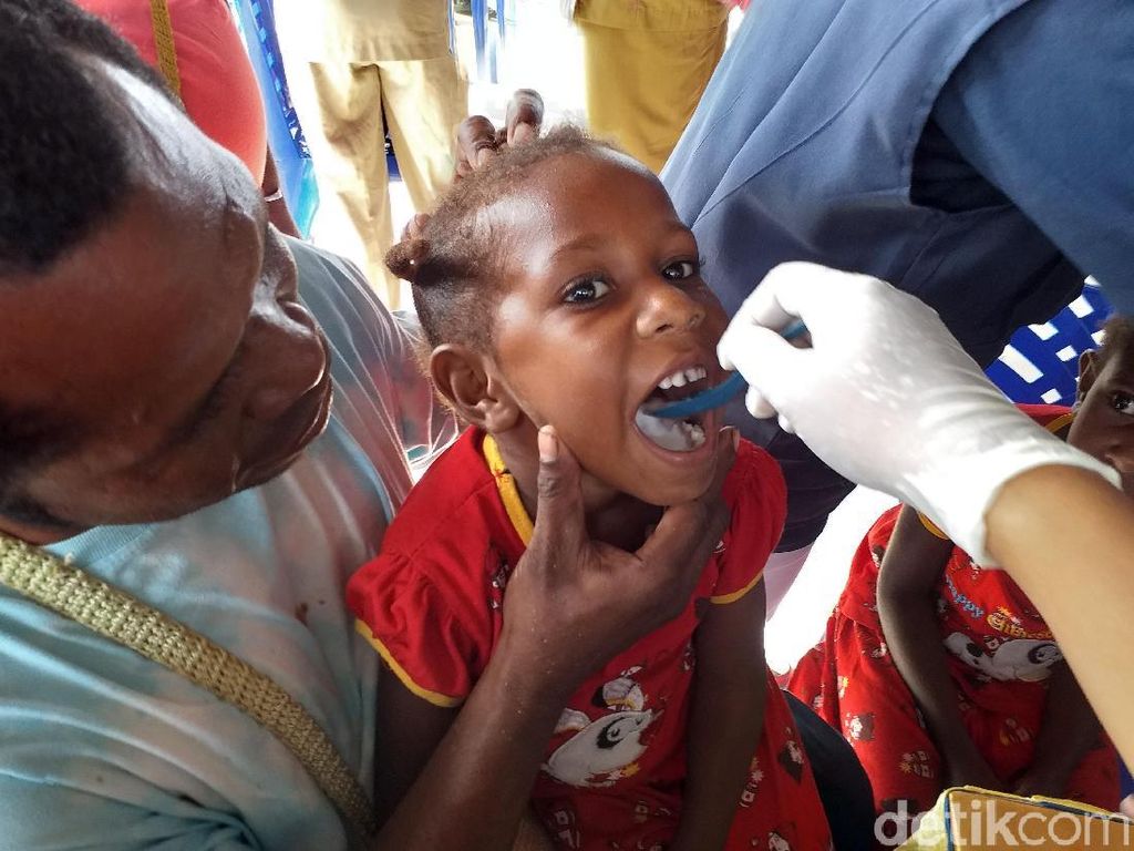 Tercatat Ada 3 Kasus, Kemenkes Tetapkan KLB Polio di Papua Tercatat Ada 3 Kasus, Kemenkes Tetapkan KLB Polio di Papua