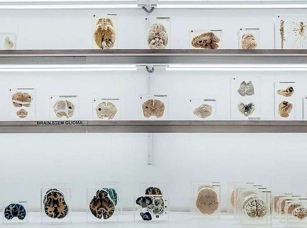Hii.. Museum di India Ini Simpan Ratusan Otak Manusia Hii.. Museum di India Ini Simpan Ratusan Otak Manusia